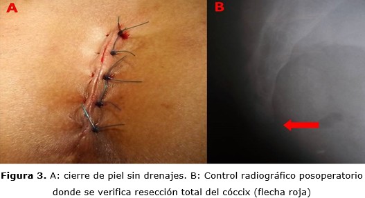 figura 3