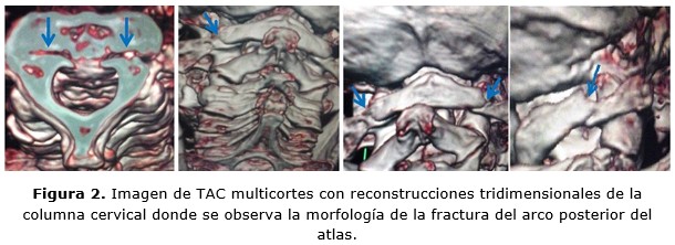 figura 2