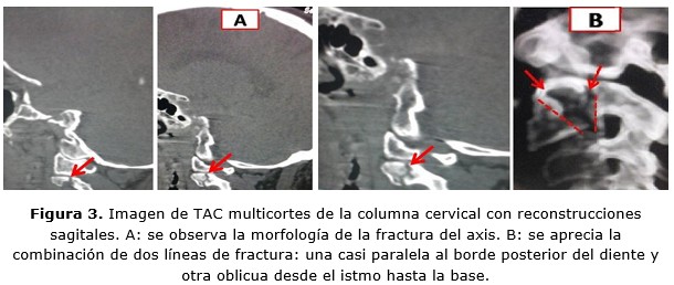 figura 3