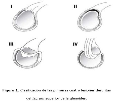 figura 1