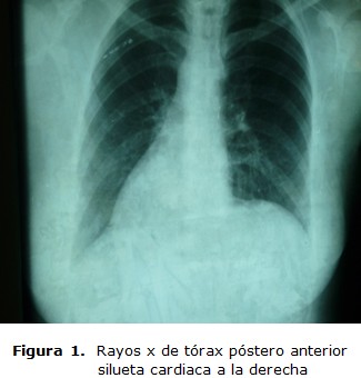 figura 1