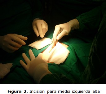 figura 2