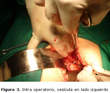 figura 3