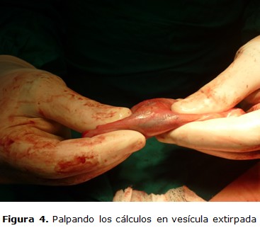 figura 4