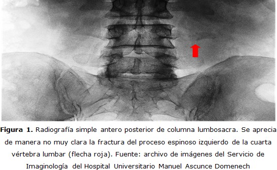 figura 1