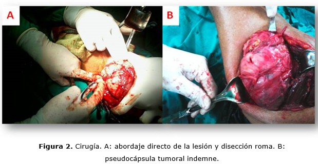 figura 2