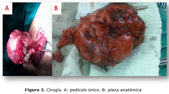 figura 3