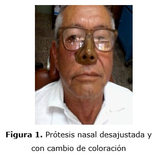 figura 1