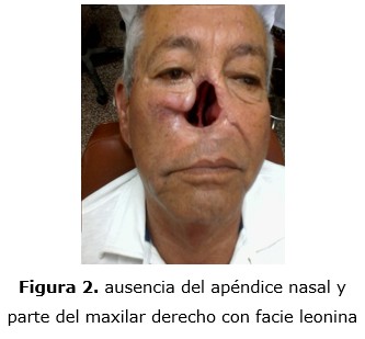 figura 2
