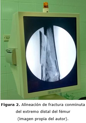 figura 2