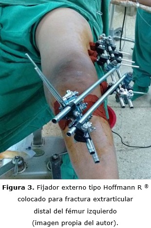 figura 3