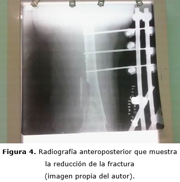 figura 4