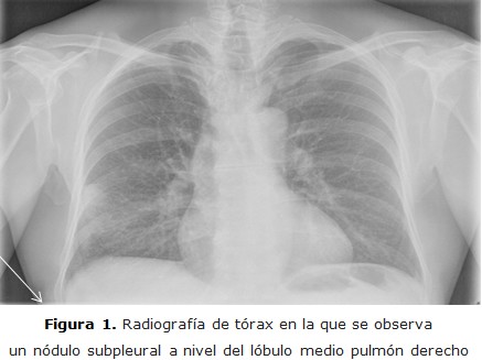 figura 1