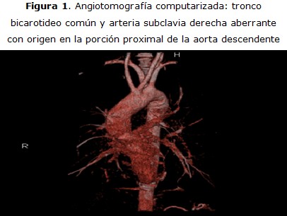 figura 1 
