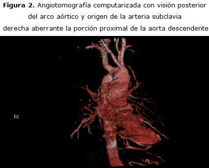 figura 2
