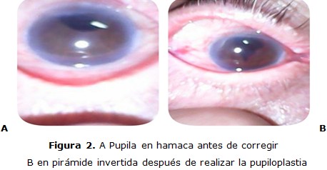 figura 2