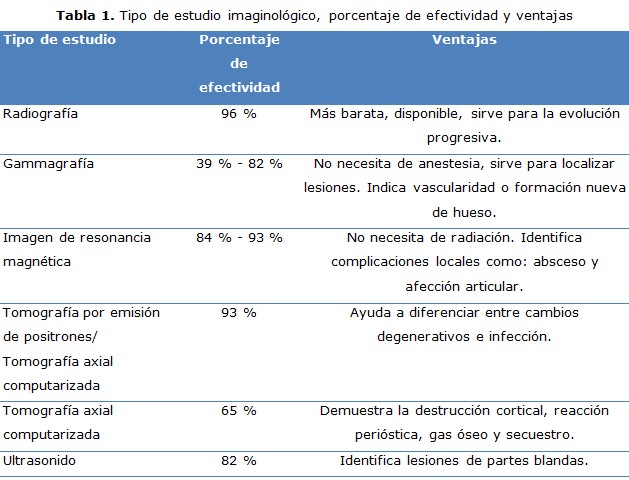 tabla 1