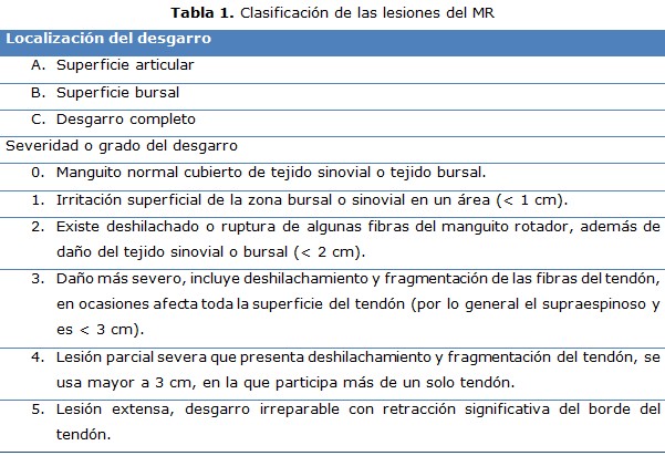 tabla 1