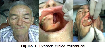 figura 1
