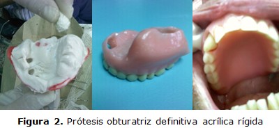 figura 2
