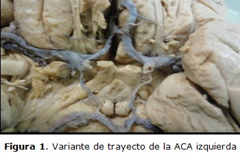 figura 1