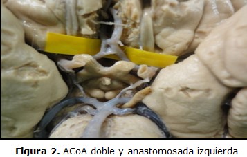 figura 2