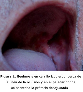 figura 1