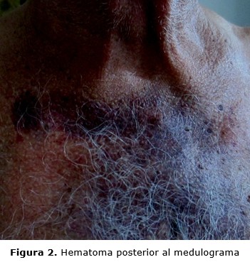 figura 2
