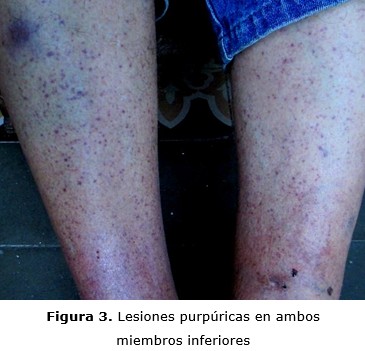 figura 3