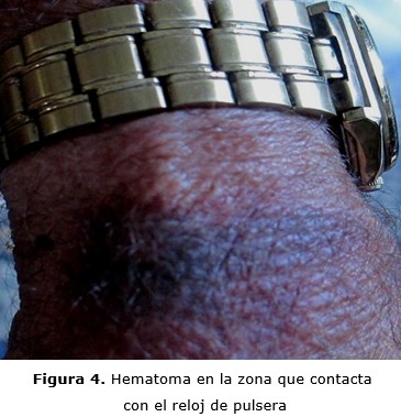 figura 4