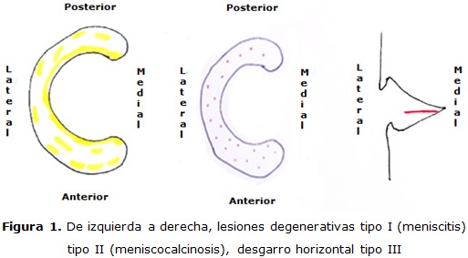 figura 1