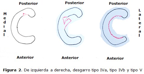 figura 2