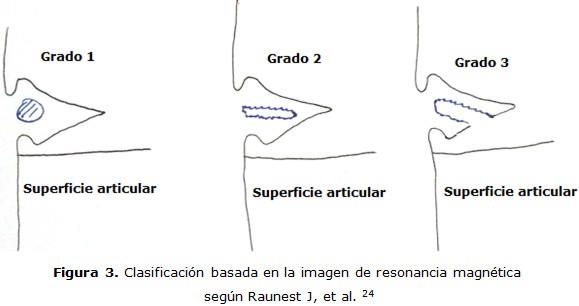 figura 3