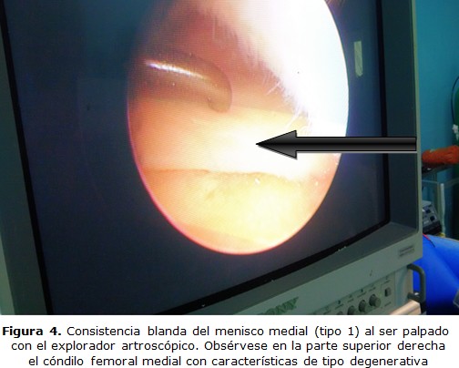 figura 4
