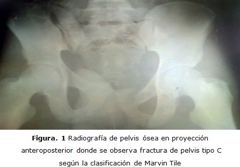 figura 1