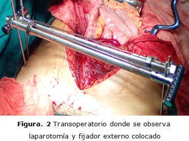 figura 2