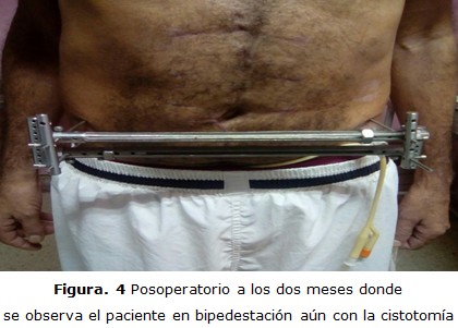 figura 4