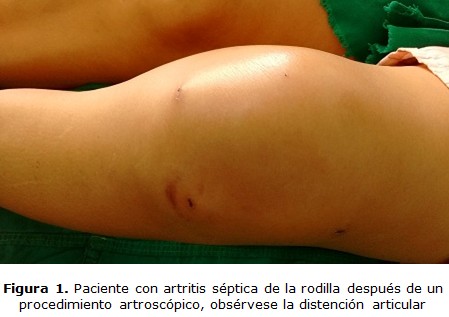 figura 1