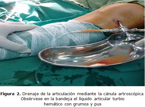figura 2