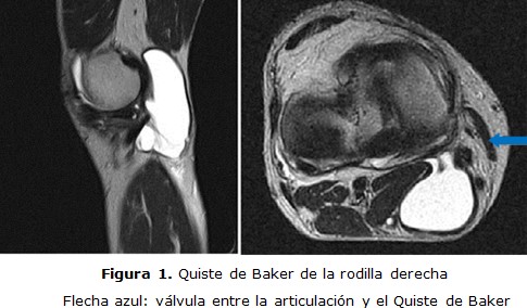 figura 1