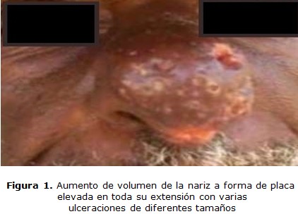 figura 1