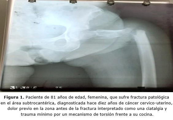 figura 1