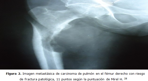 figura 2