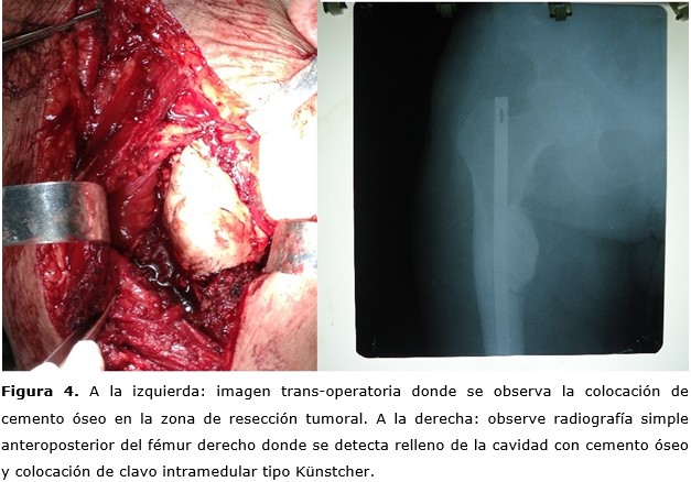 figura 4