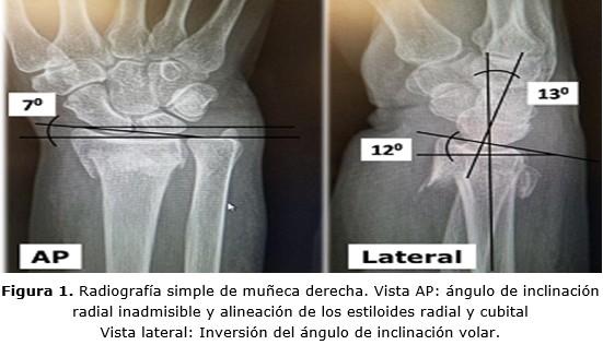 figura 1