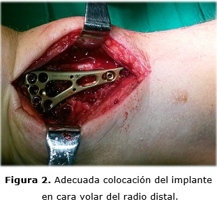 figura 2