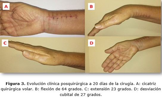 figura 3