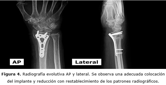 figura 4