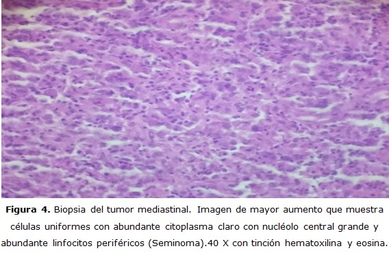 figura 4