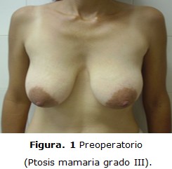 figura 1